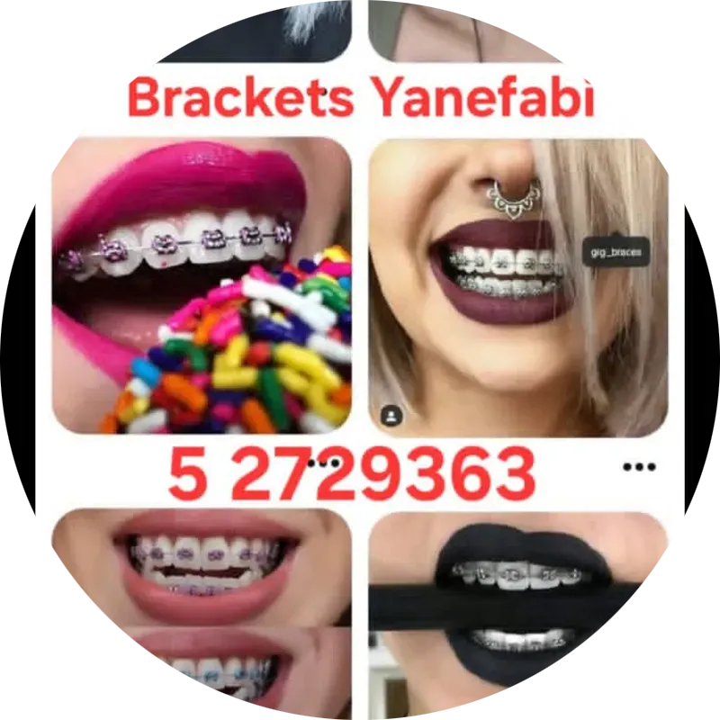 Bracketería Yanefabi